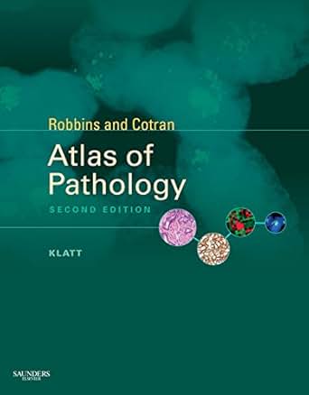 Robbins and Cotran Atlas of Pathology 2e Robbins Pathology PDF